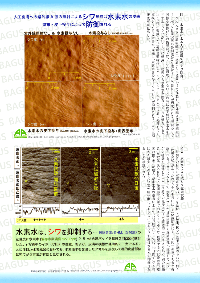 水素風呂による抗シワ・床ずれの治癒