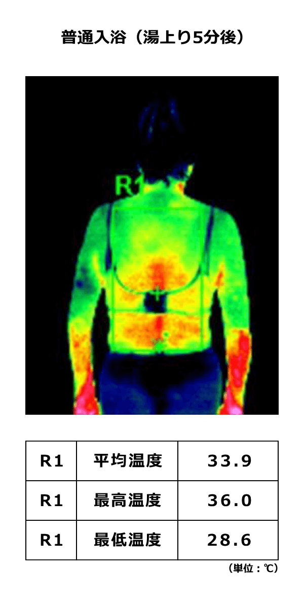 普通のお風呂に入浴した5分後のサーモグラフィ