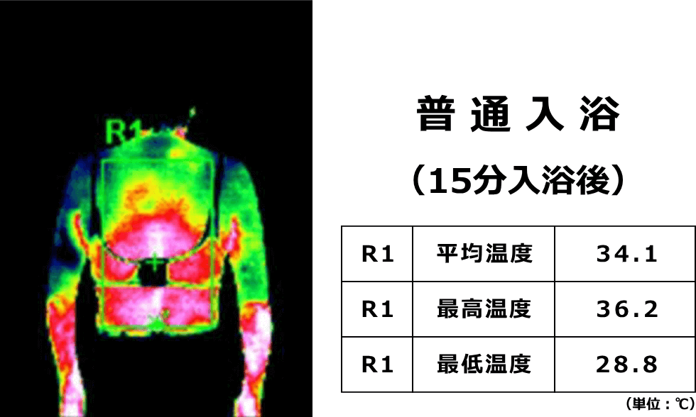 普通入浴で15分入浴した後のサーモグラフィ