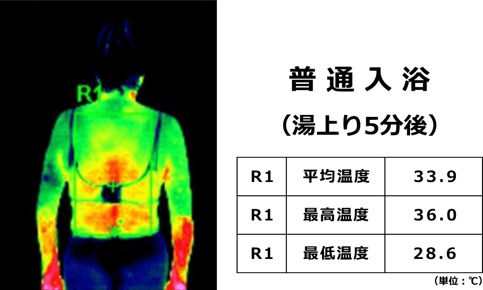 普通のお風呂に入浴した5分後のサーモグラフィ