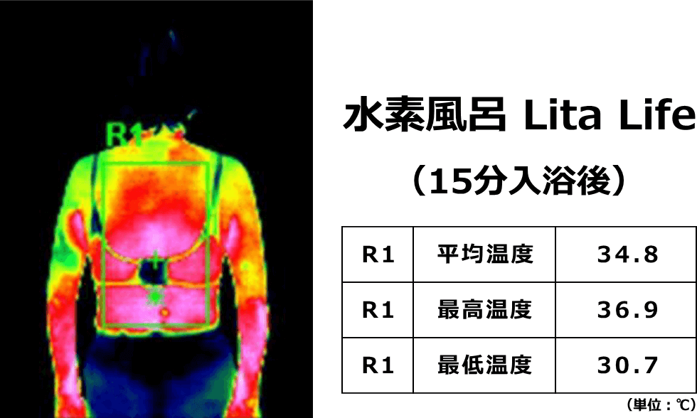 水素風呂リタライフに15分入浴した後のサーモグラフィ