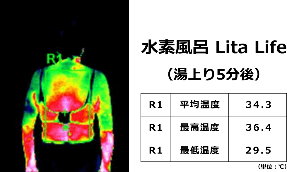 水素風呂リタライフに入浴した5分後のサーモグラフィ